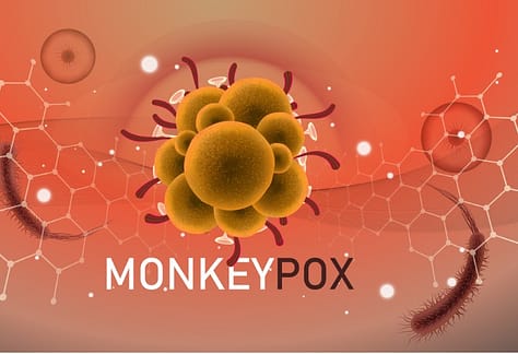 Recognize Monkeypox In Prehospital Settings